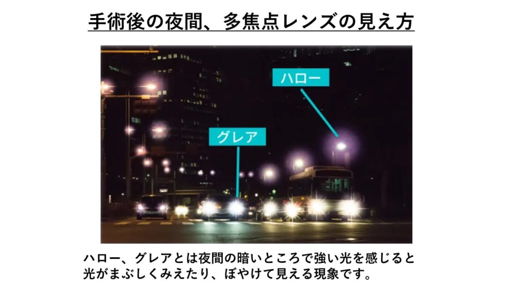 ハロー、グレア現象とは?
出典元:ふくおか眼科